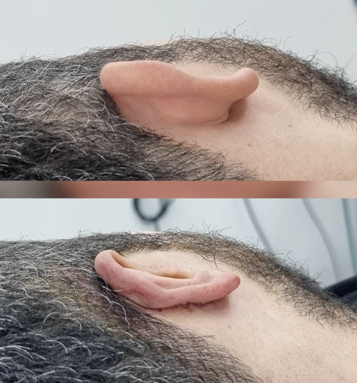 Operasyon Galerisi 3